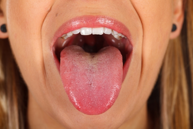 Why Does the Roof of My Mouth Hurt After Eating?